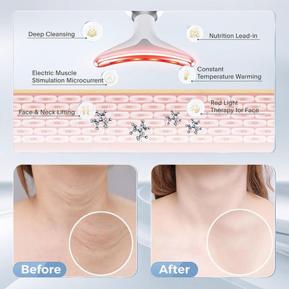 Wrinkle and Pimple Scar Removing Facial Skin Care LED Tool (𝗦𝗽𝗲𝗰𝗶𝗮𝗹 𝟭 𝗬𝗲𝗮𝗿 𝗪𝗮𝗿𝗿𝗮𝗻𝘁𝘆) 2aua6y-9x